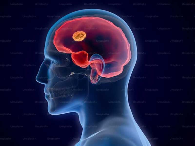 cervello-in-una-elaborazione-al-computer-gr1us