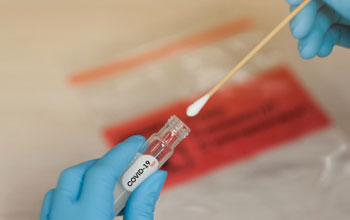 tampone-Coronavirus