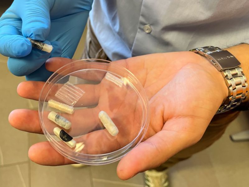 farmaco-con-stampa-4D-diventa-cerotto-anti-ulcera-2com